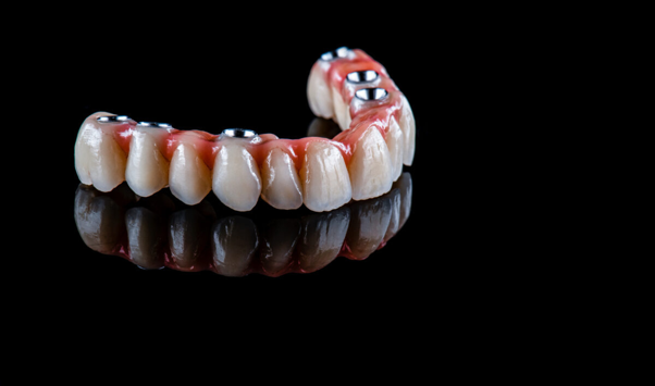 Full Mouth Dental Implants: Restoring Your Smile Completely